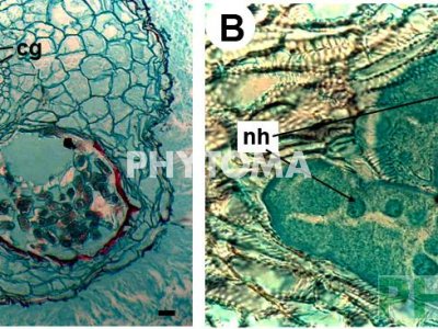 Nematodo agallador